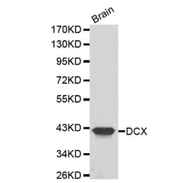 Western blot - DCX antibody from Signalway Antibody (38200) - Antibodies.com