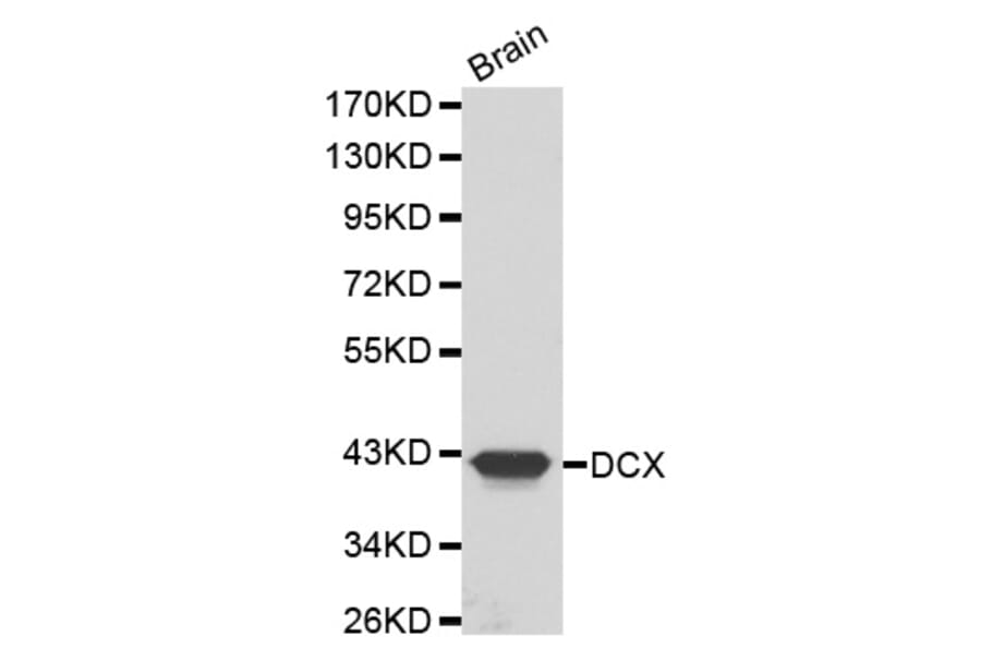Western blot - DCX antibody from Signalway Antibody (38200) - Antibodies.com