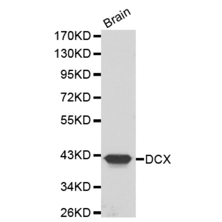 Western blot - DCX antibody from Signalway Antibody (38200) - Antibodies.com