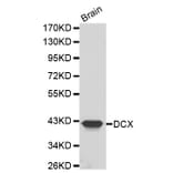 Western blot - DCX antibody from Signalway Antibody (38200) - Antibodies.com