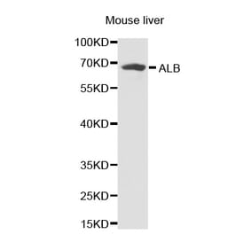 Western blot - ALB antibody from Signalway Antibody (38231) - Antibodies.com