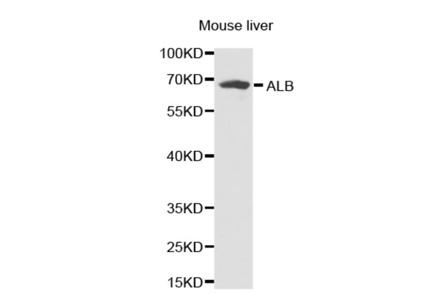 Western blot - ALB antibody from Signalway Antibody (38231) - Antibodies.com