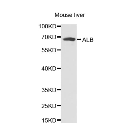 Western blot - ALB antibody from Signalway Antibody (38231) - Antibodies.com