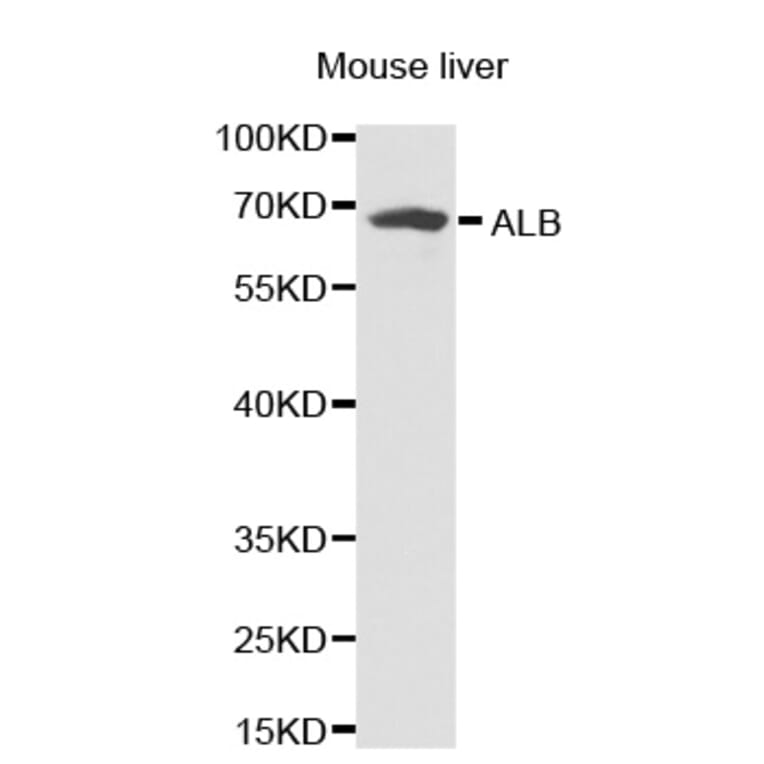 Western blot - ALB antibody from Signalway Antibody (38231) - Antibodies.com