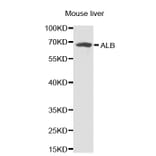 Western blot - ALB antibody from Signalway Antibody (38231) - Antibodies.com