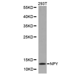 Western blot - NPY antibody from Signalway Antibody (38246) - Antibodies.com