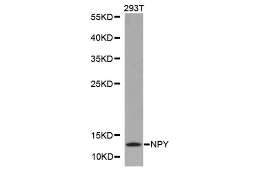 Western blot - NPY antibody from Signalway Antibody (38246) - Antibodies.com