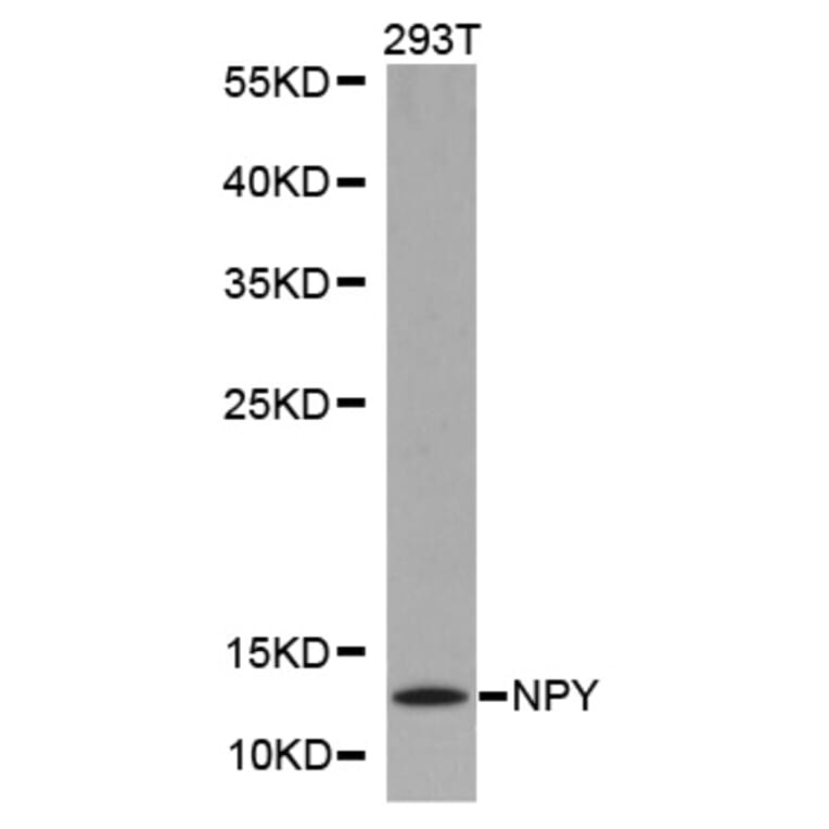 Western blot - NPY antibody from Signalway Antibody (38246) - Antibodies.com