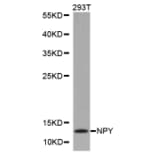 Western blot - NPY antibody from Signalway Antibody (38246) - Antibodies.com