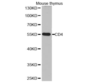 Western blot - CD4 antibody from Signalway Antibody (38251) - Antibodies.com