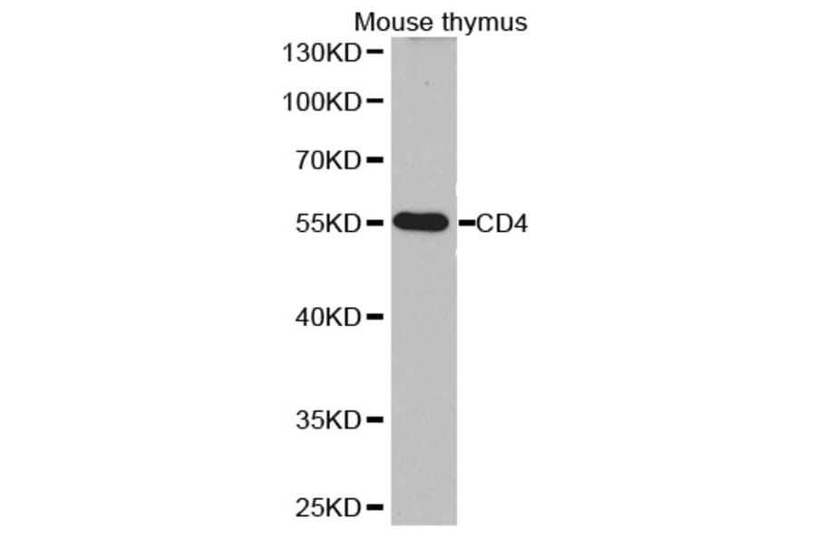 Western blot - CD4 antibody from Signalway Antibody (38251) - Antibodies.com