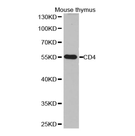 Western blot - CD4 antibody from Signalway Antibody (38251) - Antibodies.com