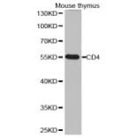 Western blot - CD4 antibody from Signalway Antibody (38251) - Antibodies.com