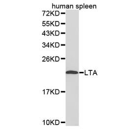 Western blot - LTA antibody from Signalway Antibody (38252) - Antibodies.com