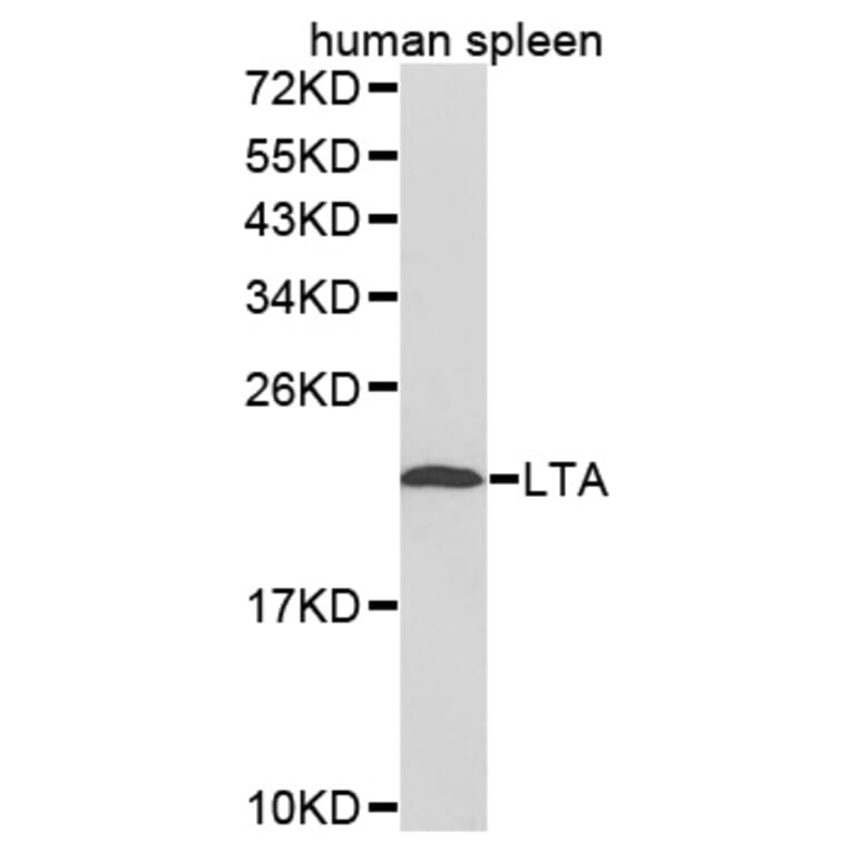 Western blot - LTA antibody from Signalway Antibody (38252) - Antibodies.com
