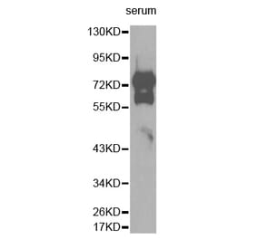 Western blot - VTN antibody from Signalway Antibody (38277) - Antibodies.com