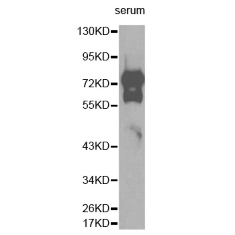 Western blot - VTN antibody from Signalway Antibody (38277) - Antibodies.com