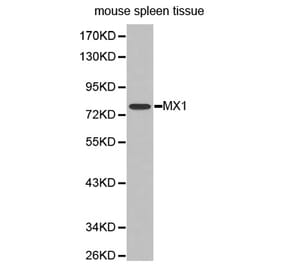 Western blot - MX1 antibody from Signalway Antibody (38296) - Antibodies.com