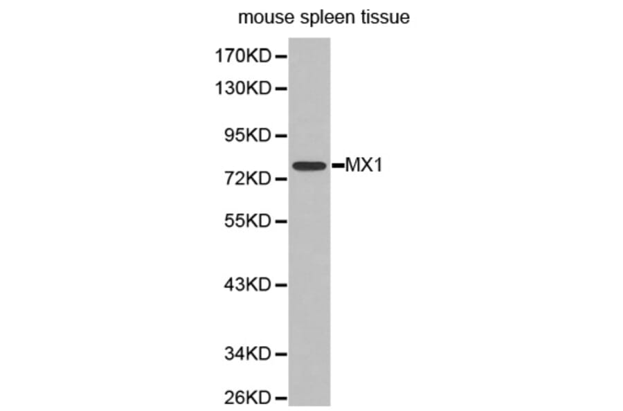 Western blot - MX1 antibody from Signalway Antibody (38296) - Antibodies.com