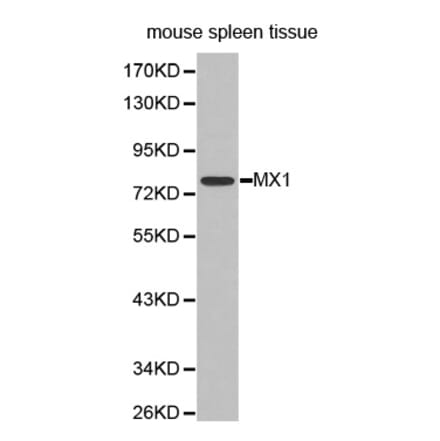 Western blot - MX1 antibody from Signalway Antibody (38296) - Antibodies.com