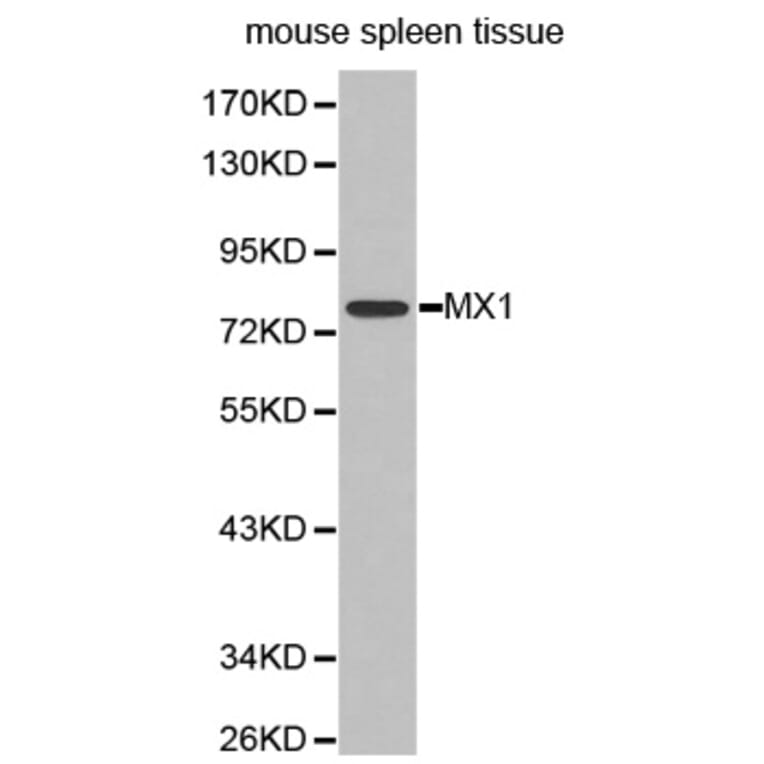 Western blot - MX1 antibody from Signalway Antibody (38296) - Antibodies.com