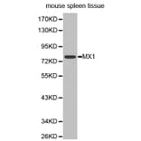 Western blot - MX1 antibody from Signalway Antibody (38296) - Antibodies.com