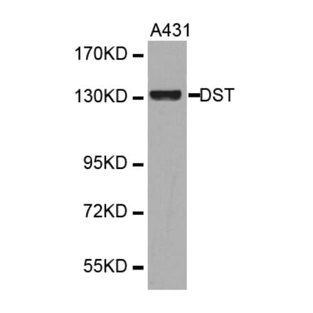 Western blot - DST antibody from Signalway Antibody (38334) - Antibodies.com