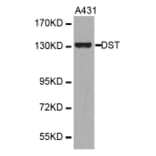 Western blot - DST antibody from Signalway Antibody (38334) - Antibodies.com