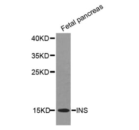 Western blot - INS antibody from Signalway Antibody (38355) - Antibodies.com