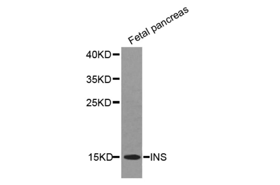 Western blot - INS antibody from Signalway Antibody (38355) - Antibodies.com