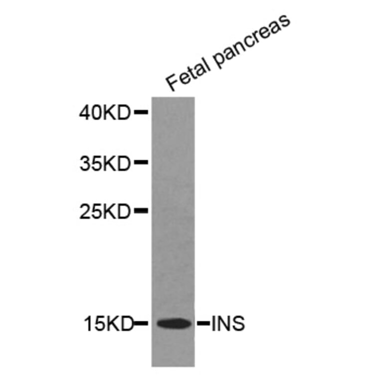 Western blot - INS antibody from Signalway Antibody (38355) - Antibodies.com