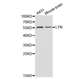 Western blot - LYN antibody from Signalway Antibody (38357) - Antibodies.com