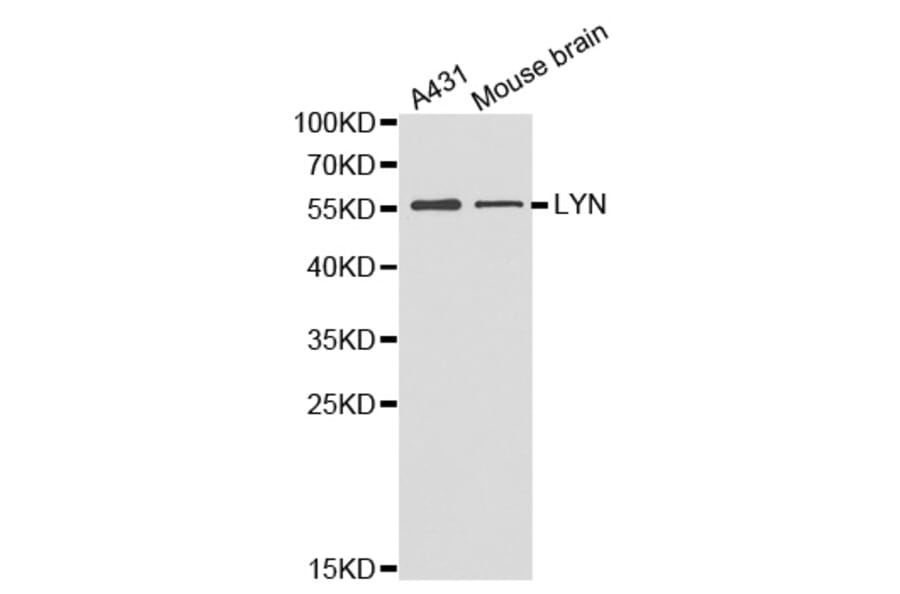 Western blot - LYN antibody from Signalway Antibody (38357) - Antibodies.com