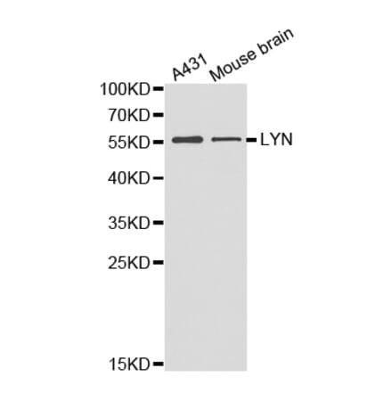 Western blot - LYN antibody from Signalway Antibody (38357) - Antibodies.com