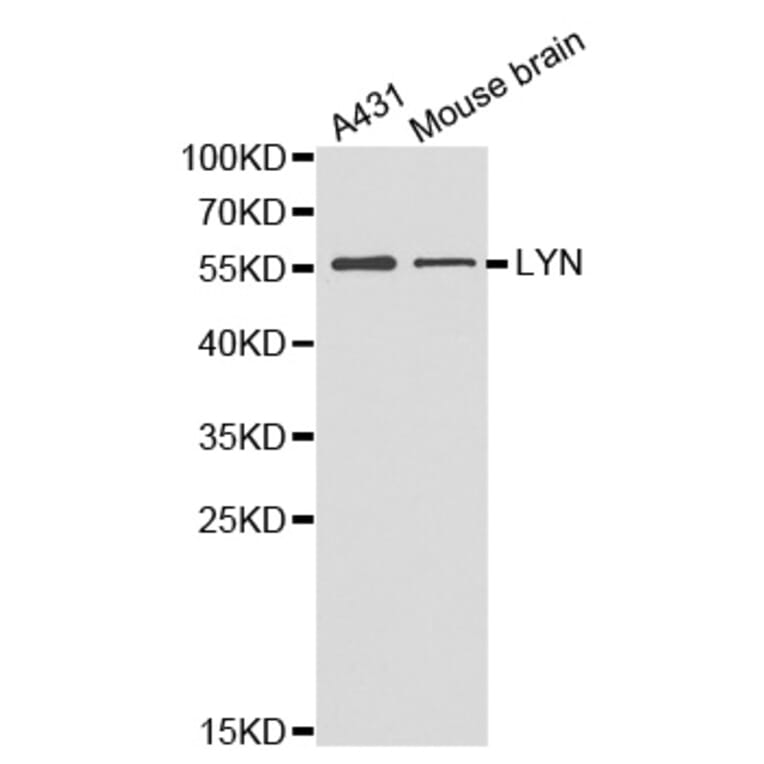 Western blot - LYN antibody from Signalway Antibody (38357) - Antibodies.com