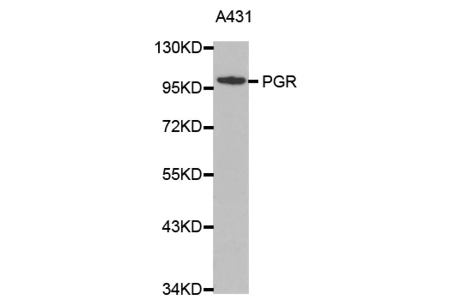 Western blot - PGR antibody from Signalway Antibody (38366) - Antibodies.com