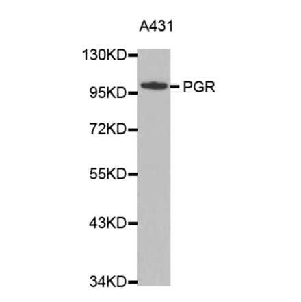Western blot - PGR antibody from Signalway Antibody (38366) - Antibodies.com