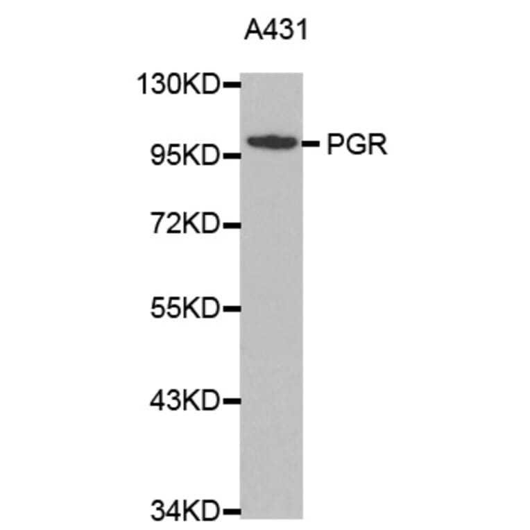 Western blot - PGR antibody from Signalway Antibody (38366) - Antibodies.com