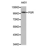 Western blot - PGR antibody from Signalway Antibody (38366) - Antibodies.com