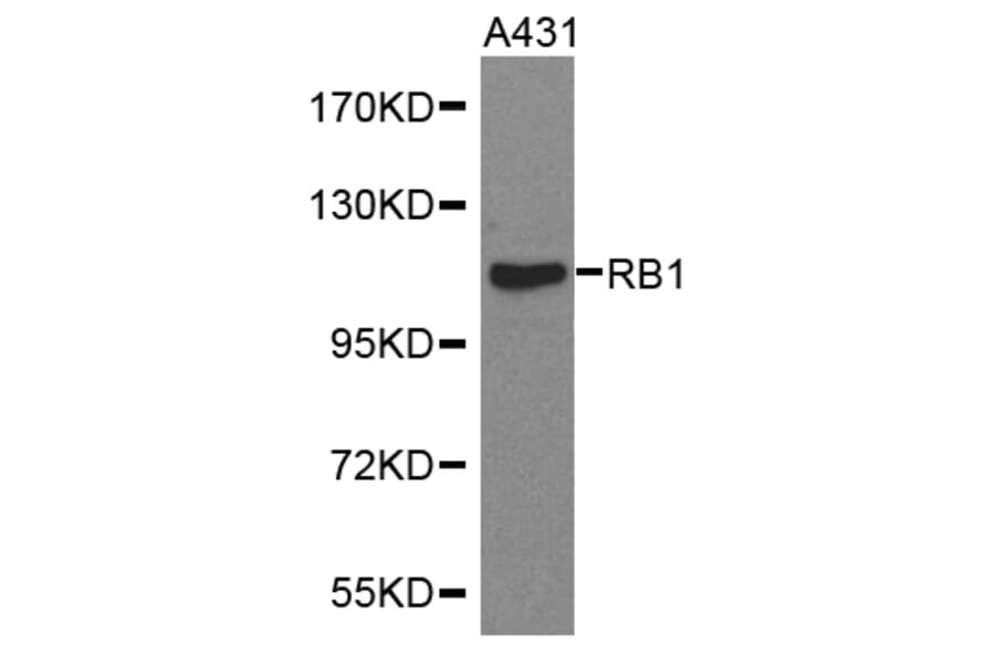 Western blot - RB1 antibody from Signalway Antibody (38368) - Antibodies.com
