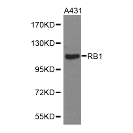 Western blot - RB1 antibody from Signalway Antibody (38368) - Antibodies.com