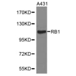 Western blot - RB1 antibody from Signalway Antibody (38368) - Antibodies.com