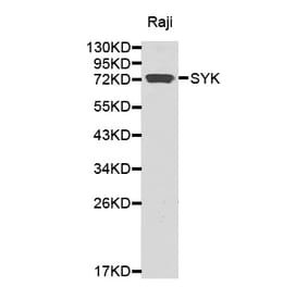 Western blot - SYK antibody from Signalway Antibody (38370) - Antibodies.com