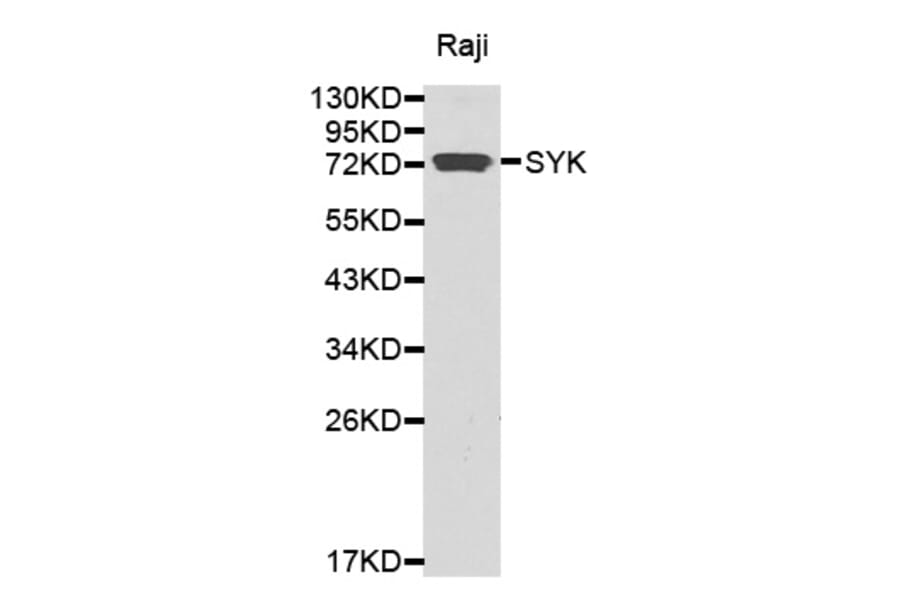 Western blot - SYK antibody from Signalway Antibody (38370) - Antibodies.com