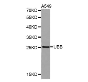 Western blot - UBB antibody from Signalway Antibody (38375) - Antibodies.com