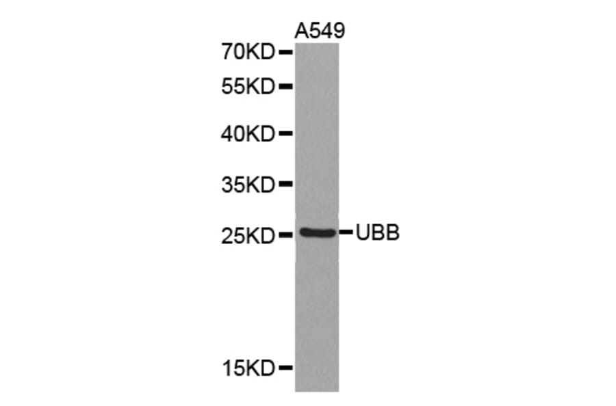 Western blot - UBB antibody from Signalway Antibody (38375) - Antibodies.com