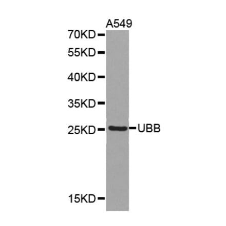 Western blot - UBB antibody from Signalway Antibody (38375) - Antibodies.com