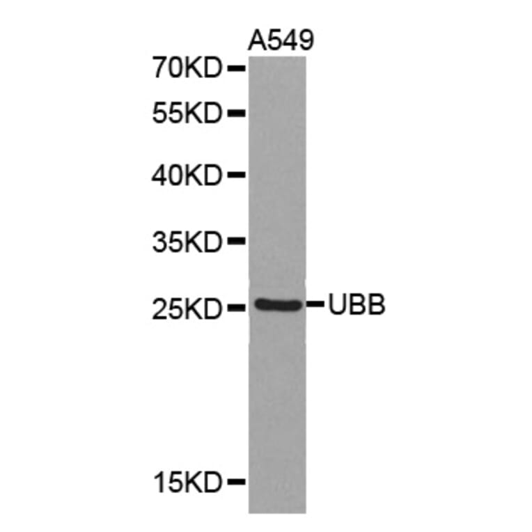 Western blot - UBB antibody from Signalway Antibody (38375) - Antibodies.com