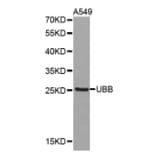 Western blot - UBB antibody from Signalway Antibody (38375) - Antibodies.com