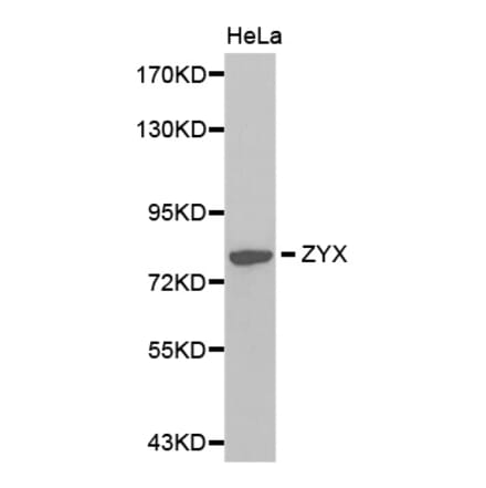 Western blot - ZYX antibody from Signalway Antibody (38377) - Antibodies.com